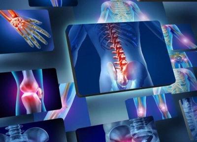 استفاده از داروی سرطان برای بیماری های التهابی