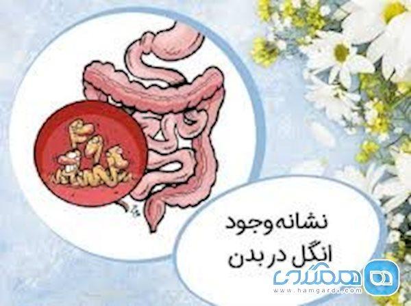 علائم وﺟﻮد اﻧﮕﻞ در بدن چیست؟