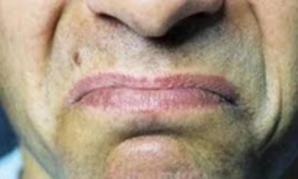 علل احساس طعم تلخ در دهان علل احساس طعم تلخ در دهان